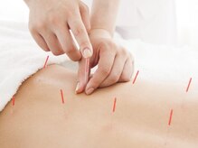 ミズノ接骨院 ミズノ鍼灸マッサージ院