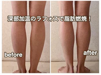 プライベートサロン サイ(sai)/深部から温め。痩せ体質に！