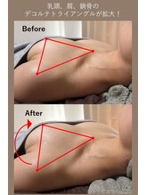 ハーグレイス 表参道外苑前(Her Grace)/バストアップ/バストケアBA