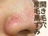 【夏皮脂のメイク浮き対策】開き毛穴・黒ずみ・ざらつきケア