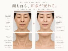 【たるみケア・シミケア・毛穴】エイジングケアAreum(アルム)戸塚の雰囲気(【30~50代の方にお勧め】光フォト・ピーリングなど豊富な施術♪)
