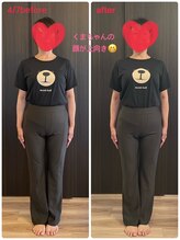 深層整筋サロン/施術before＆After(50代女性)