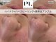 プルスキンサロン 大阪店(pull skin salon)の写真