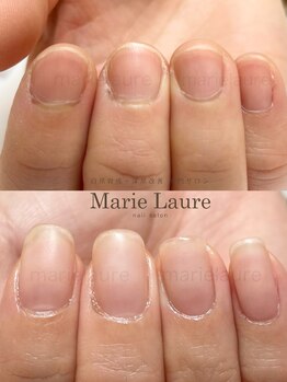 マリーロール 淀屋橋本店(Marie Laure)/自爪育成/深爪矯正/ネイルケア