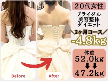 マラウェイ(Mullaway)/ ブライダル実績(痩身/美容整体)