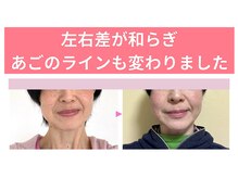 プランドール/左右差が緩和されました♪