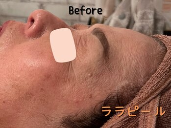 ダイヤモンド リーエンダ(Diamond leende)/ララピール