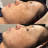 アイラッシュ ラピス(Lapis)