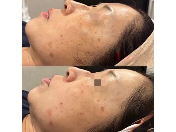 アイラッシュ ラピス(Lapis)