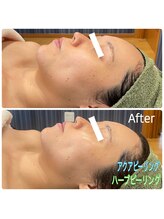 エクセレントビューティーサロン 艶(EN)/くすみ改善・透明感アップ