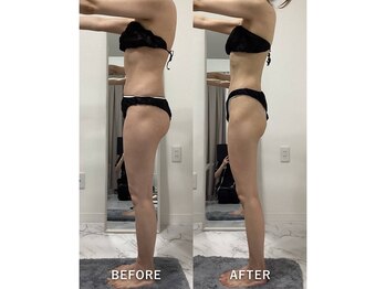 ナルシス/【痩身】モデル体型に★