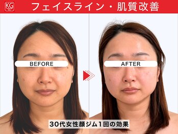 顔ジム 麻布店/30代女性顔ジム1回の効果