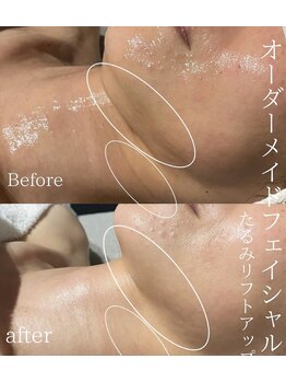 アンジー(an.g)/疲れ顔解消!引上げたるみケア