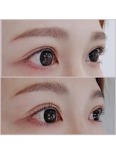 アイラッシュサロン モッペル(Eyelash Salon Moppel)/ラッシュリフト
