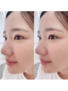 トワエモア バイ シーン(Toi et moi by SCENE)/ラッシュリフト/ストレート