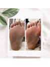カサカサかかと解消!角質ケア