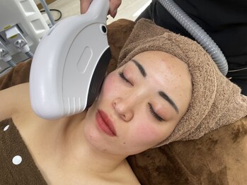 モエザ(MoeZ)の写真/【年齢とともに1番気になるホウレイ線やたるみは改善できます!!】お気軽に今の状態をご相談ください◎
