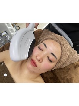 ホウレイ線・たるみ改善！予防ケア