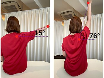 あいき整体院/BA〔整体/肩こり/腰痛/産後〕