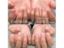 エルミュ(elmu)の雰囲気（自爪育成）