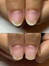 深爪矯正/自爪育成/ネイルケア