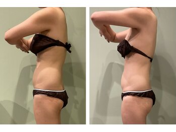 アトリエール(Ateliere)/姿勢整う女性らしいボディライン