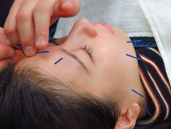 えん鍼灸院 整骨院/