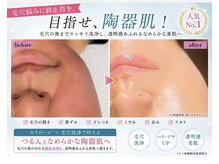 ユキエル(yukielle)の雰囲気(第4世代韓国LHAピーリング“セラピール”正規取扱サロン)