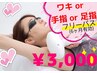 ワキor手指or足指脱毛 フリーパス3000円!! ※要事前シェービング【学割U24】