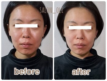 サロン オリ(salon_oli)/お顔の土台からリフトアップ◎