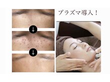エステティックサロン リリアン