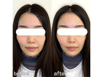 整え屋 レッド(RED)/阿波座/本町/小顔矯正/美容整体