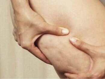 セリーナ(CELINA)の写真/「運動が苦手」「ダイエットが続かない」そんな方にぴったり♪短時間でしっかり実感!通いやすい痩身エステ
