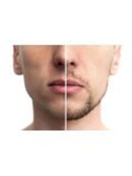 ビューティー モア 長岡店(More)/メンズヒゲ脱毛