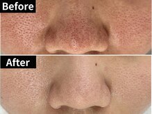 パルテール/色々と試し過ぎた結果赤みになる