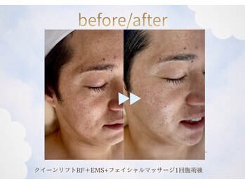 ルーム701(room701)/天王寺フェイシャル専門店