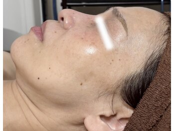 メディカルサロン かとれあ/ダクトピール