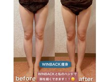 サロンデイジー(Salon Daisy)の雰囲気( WINBACK×手技で巡りを促進。むくみ重だる脚をスッキリ引き締め)