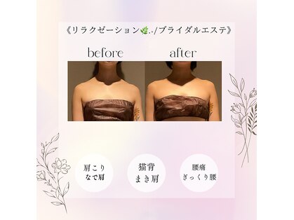 アミュレット(AMULET)の写真