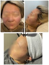 グレイス(GRACE)/