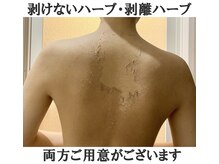 フロージア 新宿南口店(FLOGIEIA)/小顔ハーブピーリングフロージア