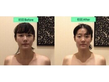 アジール 新潟市(agir)/Before/After画像