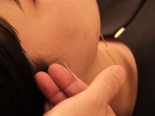 コハルはり灸整骨院(koharuはり灸整骨院)の雰囲気（敏感肌の方/肌荒れしやすい方もOK◎お化粧したまま施術できます）