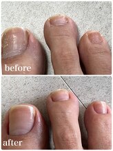 爪屋/ジェルネイルで痛んだ爪