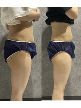 リボーン(REBORN)/産後ケアーダイエット