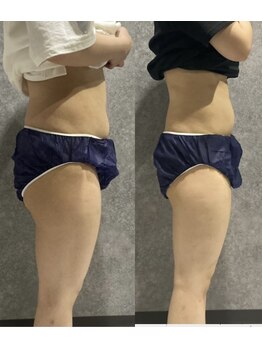 リボーン(REBORN)/産後ケアーダイエット