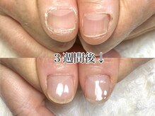 グレースレディ 大阪店/(深爪/長さだし/フィルイン/)