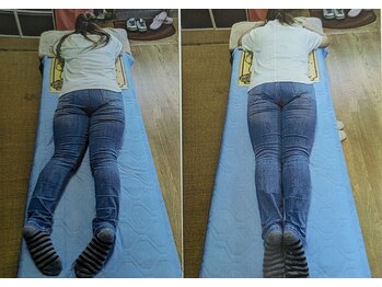 悠楽/慢性的の肩こり・腰の痛み症状。