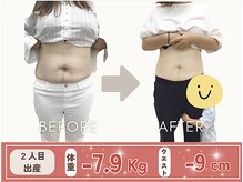 たどころ整骨院/産後骨盤矯正ダイエットの結果！
