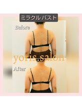 ヨリーズサロン(yoris.salon)/二の腕＆バスト＆背中整える★